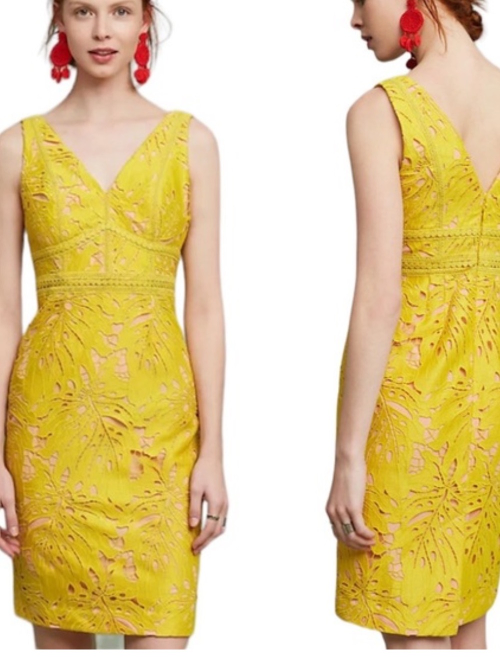 Anthropologie Yellow Lace Dress
